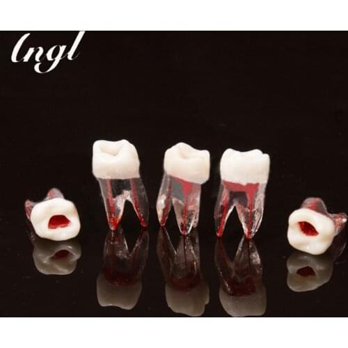 1pc Dental Tooth Root Canal Model for RCT Practice Pulp Dentistry Lab Model Dental Materials Dentist Tools