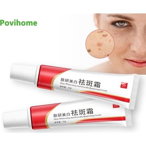 1/2/3pcs Skin Spot Remover Whitening Facial Cream Whitening Lightening Freckle Cream Remove Melasma Acne Spots Pigment P1171