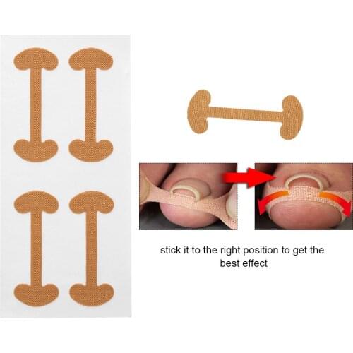 30 Set Toe Stickers Nail Protector Pedicure Groove Ingrown Device Thumb Separator Deformed Corrector Feet Care Orthosis Manicure