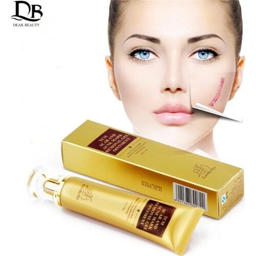 Stretch Marks Remove Dropshipping Discounted Price Acne Scar Treatment Whitening Cream Pimple Scar Pregnancy Nourish Skin Care