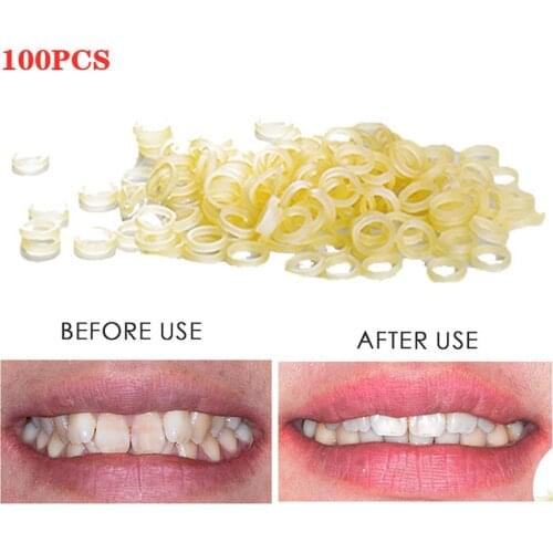 Clearance Cheap Price 100pcs Dental Materials Disposable Rubber Ring 6.35mm Ligation Ring