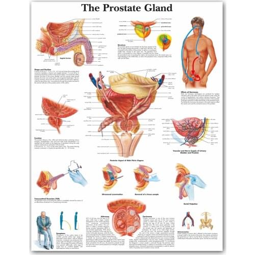 WANG ART back to school Prostate Gland Anatomical Charts Posters Anatomy Canvas Print Wall Pictures Medical Education Office