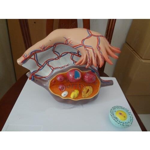 Human Ovarian Structure Ovarian Enlargement Plan Parenthood Demonstration Model for Medical and Beauty Parlor Free Shipping