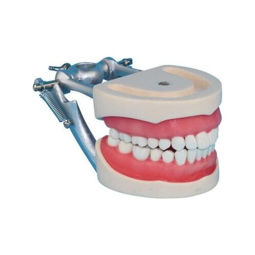 Prosthodontics model Dental Prepared teeth Dentition free shipping