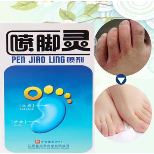 Gaitianling unisex foot spray anti-itching, sterilizing, deodorizing and antibacterial spray 60ml/bottle