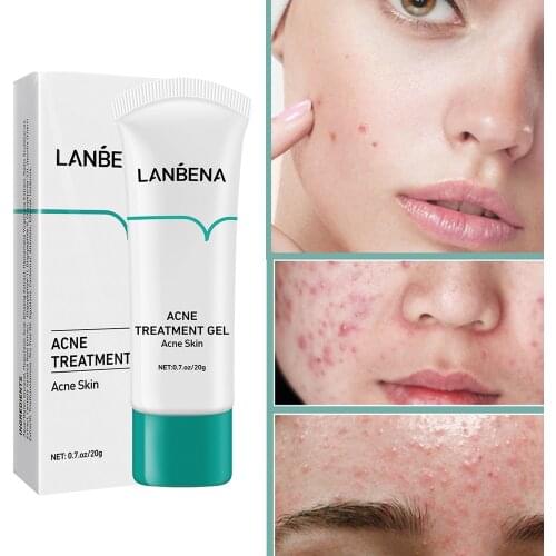 20g LANBENA Acne Treatment Face Cream Blackhead Removal Damage Fade Marks Repair Acne Scars Gel Shrink Pores Whitening Skin Care