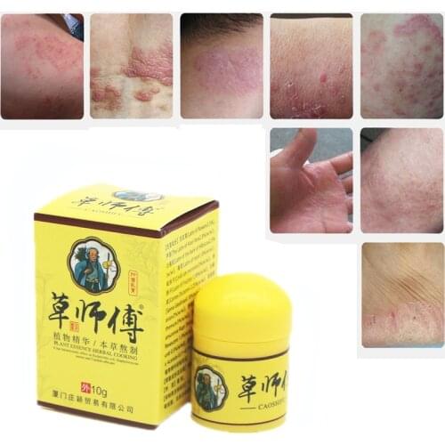 1pc Psoriasis Eczma Cream Works Perfect for All Kinds of Skin Problems Patch Body Massage Ointment Chinese Herbal Medicine