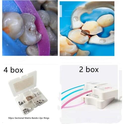 Full Kit Dental Matrix Sectional Contoured Matrices Dental Polishing Strip 4mm*6m Matrix Bands Dental Tools Dentist Material