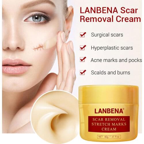 Acne Scar Removal Stretch Mark Cream Repair Moisturizing Skin Care for Women SK88
