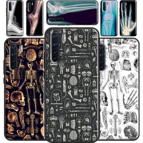 X-Ray Human Anatomy Case For OPPO A93 A91 A83 A5 A9 A31 A53 2020 A52 A72 A15 A3S A5S F5 Find X3 Pro Cover Capa