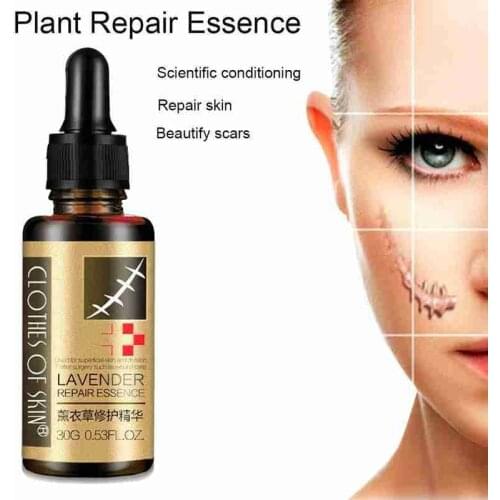 30ml Lavender Essence Scar Repair Skin Essential Oil Natural Pure Remove Ance Burn Strentch Marks Scar Removal