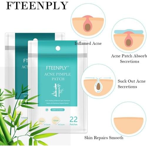 FTEENPLY Acne Pimple Patch Invisible Acne Stickers Blemish Treatment Breathable Acne Master Pimple Remover Beauty Tool Skin Care