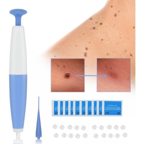 Skin Tag Removal Kit Face Care Home Treatment Non Toxic With Cleansing Swabs For Small To Medium Micro Band Body Mole Wart Adult