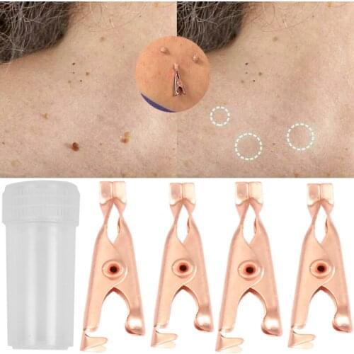Small Clip Copper Tag Remover Skin Care Wart Remover Micro Strip Cleaning Skin Tag Removal Kit Facial Beauty Makeup Tools 1/2pcs