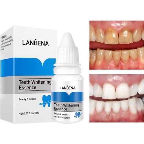 Стоматологические инструменты SUOLAER China At AliExpress