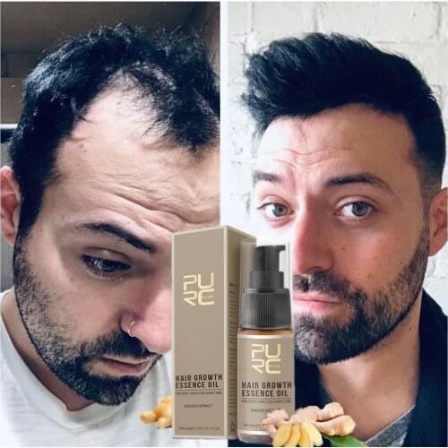 PURC Hair Growth Spray Hair Growth Shampoo Hair Growth Products Prevent Treat Bald Hair loss Men Women Hair Care Beauty Products