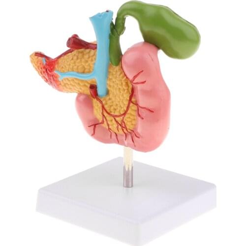 Lifesize Human Pancreas Duodenum Gallbladder Pathological Model with Blood