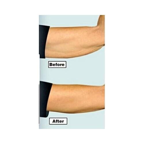 OPP bag pack arm slim tape makes arms look firm and younger arm shaping transparent lifting strips sticker AS SEEN ON TV
