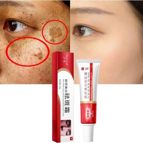 Anti-Freckle Cream Whitening Invisible Blemish Cream Remove Melanin Acne Spot Gentle Non-irritating Moisturizing Gel Skin Care