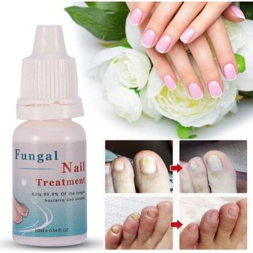 Nail Repair Serum Liquid Moisturizing Repair Onychomycosis Fingernail And Toenail Fungus Rapid Sterilization Care TSLM1