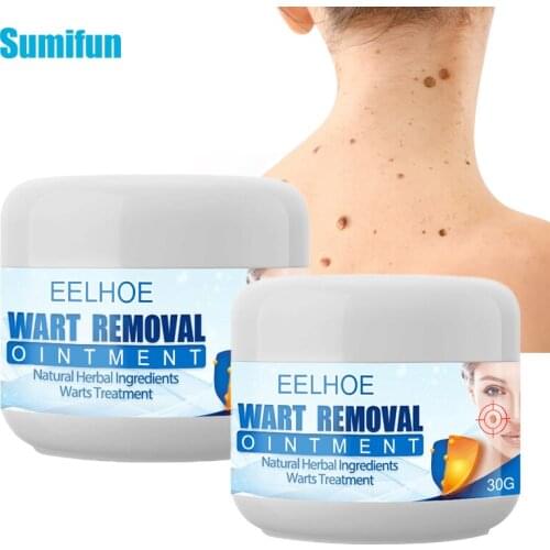 30/50g Warts Remover Cream Skin Tag Remover Thorn Pain Relief Cream Antibacterial Wart Treatment Herbal Extract Ointment