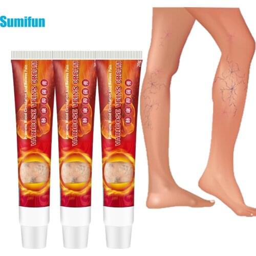 1pcs Ointment For Varicose Veins Of Legs Varicose Veins Cream Varicosity Angiitis Remedy Treatment Phlebitis Pain Relief P1109