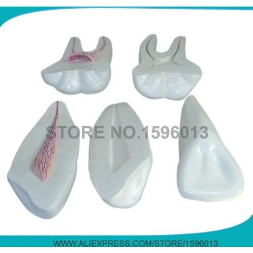 HOT Teeth Model include incisor canine and molar teeth 3pcs/set, Expansion Model of Human Teeth