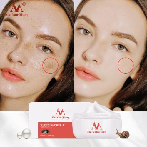 Powerful Whitening Freckle Cream 40g Remove Melasma Acne Spots Pigment Melanin Dark Spots Face Lift Firming Face Care Cream skin