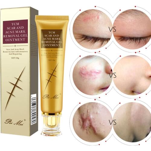 Scar Cream Gel Acne Burns Stretch Marks Bruises C-section Surgical Repair Smooth Whitening Moisturizing Body Skin Care 30g