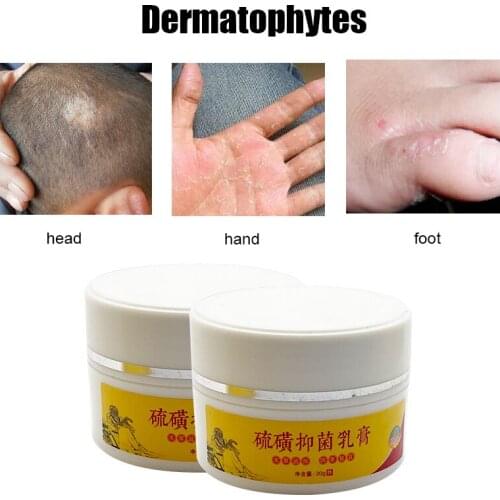 Herbal Antibacterial Sulfur Psoriasis Eczema Cream Anti-itch Relief Skin Rash Urticaria Desquamation Treatment 20g