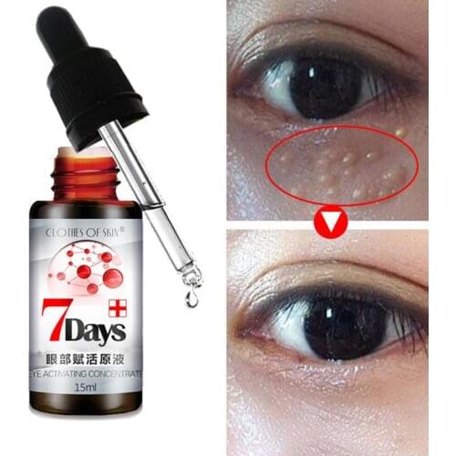 Natural Eye Serum Cream 7 Days Remove Dark Circle Bags Under The Eyes Prevent And Improve Fat Particles Improve Skin Appearance