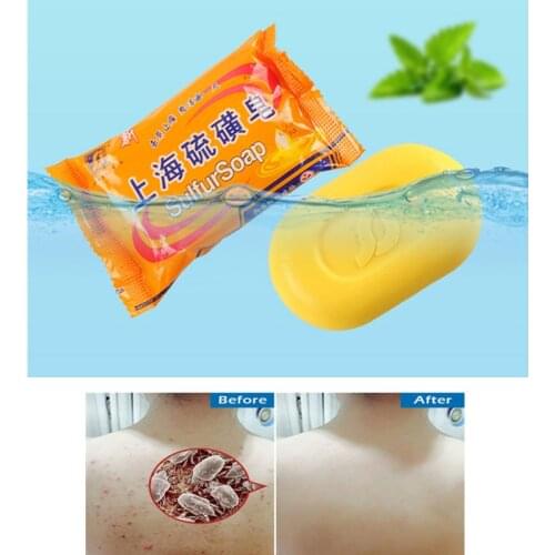 Shanghai sulfur soap oil-control acne treatment blackhead remover soap Whitening cleanser Chinese traditional Skin care TSLM1