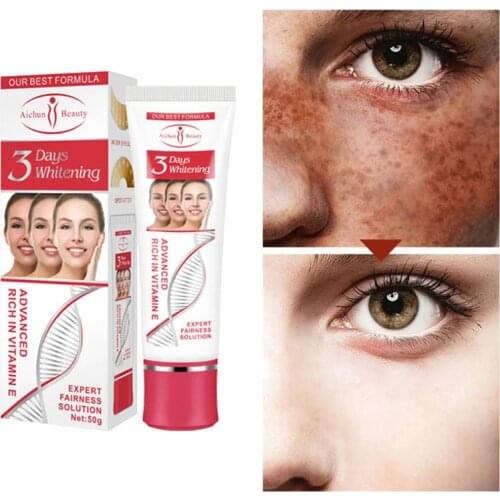 3 Days Effective Whitening Freckle Cream Remove Melasma Acne Spot Pigment Melanin Dark Spots Pigmentation Vitamin E Cream