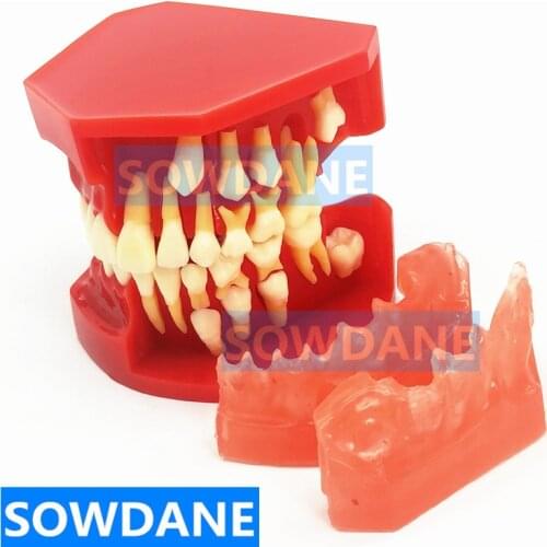 Dental Children Deciduous Teeth Model Replacement Model Permanent Teeth Alternate Display Removable Demonstration for Teaching
