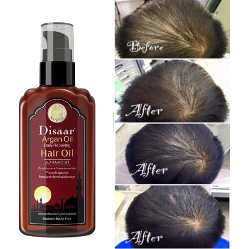 Hair Growth Essential Oil Argan Oil Nourish Scalp Repair Dry Damage Hair Treatment Nursing Glycerol Hairdressing Hair Care 120ml