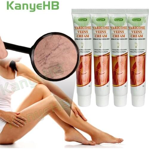 4pcs Leg Varicose Vein Treatment Cream Remove Feet Varicosity Vasculitis Medical Ointment Varicose Vein Herbs Essence Cream A642