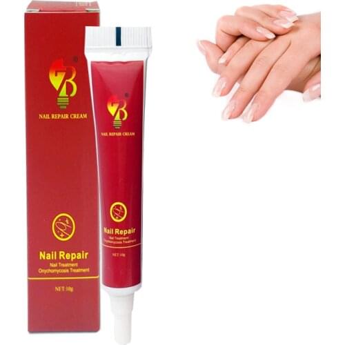 Best Chinese Medicine Herbs Nail Treatment Cream Paronychia Anti Nail Infection Fights Bacteria And Naturally