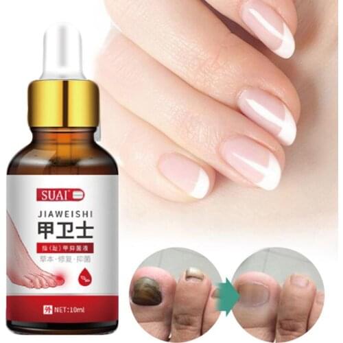 Anti Fungus Nail Treatment Essense Anti Infection Paronychia Toe Nails Fungal Repair Serum Onychomycosis Remover Hand Foot Care