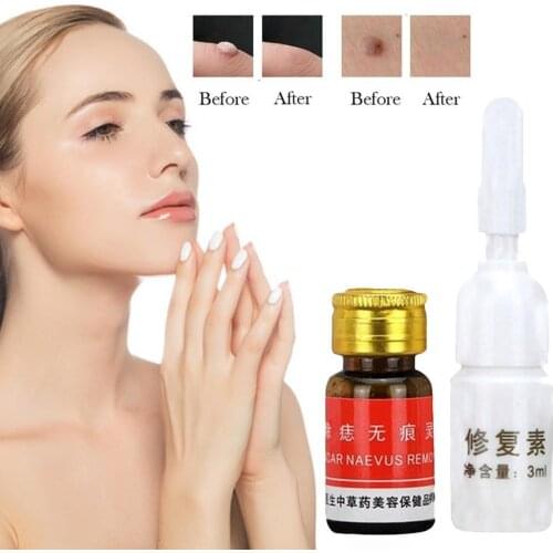 1set Mole Water Moisturizing Tag Remover Serum Mole Cream Solution Care Solution Skin Tool Removal Repair Face Care Removal
