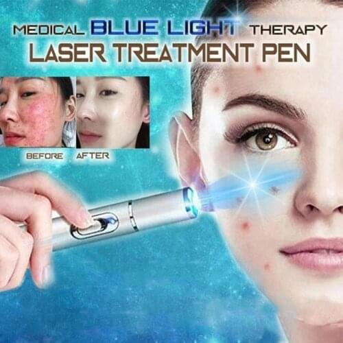 Acne Removal Pen Blue Light Therapy Varicose Veins Treatment Laser Pen Wrinkle Removal Treatment Acne Laser Pen Massage Relax