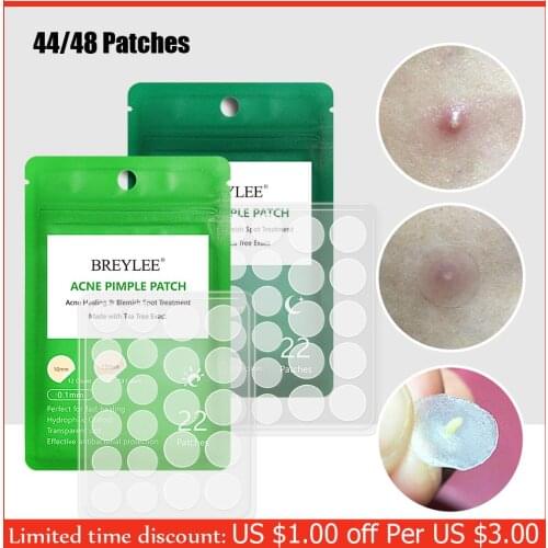 Acne Pimple Patch Stickers Acne Treatment Pimple Remover Tool Blemish Spot Facial Mask Skin Care Waterproof 44 Patches