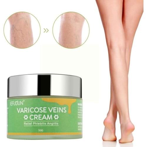 Repair Scar Treatment For Varicose Veins Chinese Herbal Medicine Legs Angiitis Veins Removal For Varicosity Phlebitis Ointm A8F4