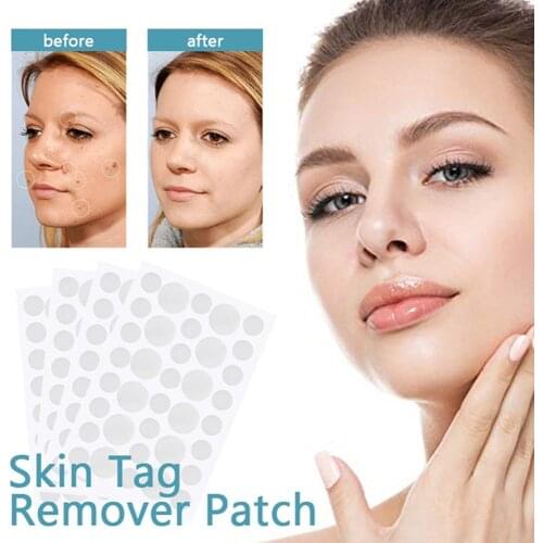 108 Pcs Skin Tag Remover Warts Remover Patches Wart Treatment Cream Herbal Extract Foot Corn Plaster Acne Warts Sticker