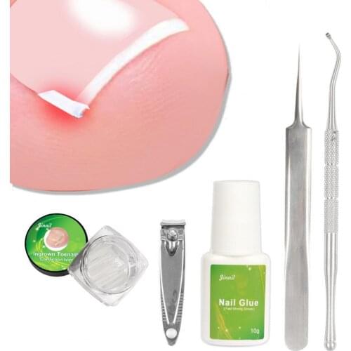 24Pcs/Set Toenail Groove Pad Set C-Shaped Slot Correct Nail Growth Flexible Mini Ingrown Toenail Patch for Adult Correction