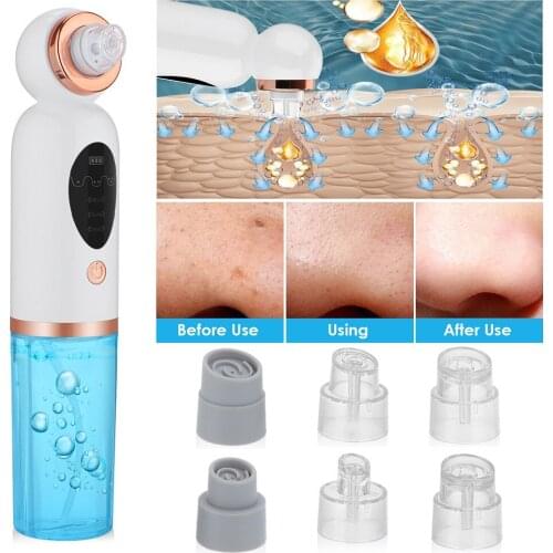 Facial Blackhead Remover Electric Acne Cleaner Blackhead Black Point Vacuum Cleaner Tool Black Spots Pore Face Care