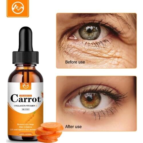 Minch Carrot Eye Serum Remove Eye Bags Blemish Anti Puffiness Dark Circles Delays Anti-wrinkles Deep Hydration Essence Eye Cream