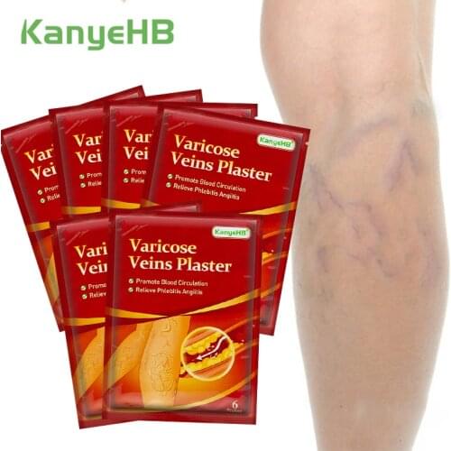 36pcs/6bag KanyeHB Varicose Vein Patch Varicose Patch Treatment Varicose Vein Vasculitis Plaster Remove Leg Varicosity CreamA597
