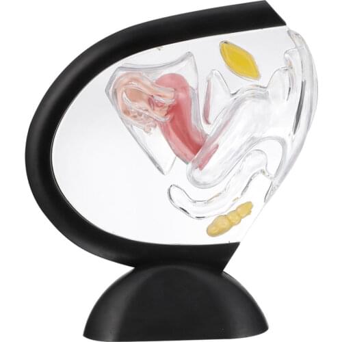 Uterus Structure Model Transparent Uterus Wall Model Research Model