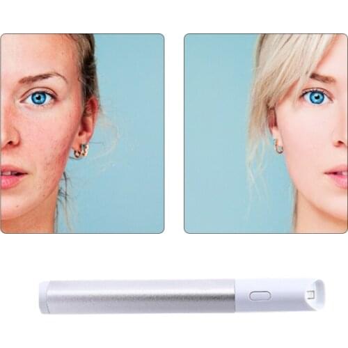 Acne Spot Laster Pen Facial Vibration Massage Instrument Electronic Negative Galvan Ion Import Export Tool Face Care Massager