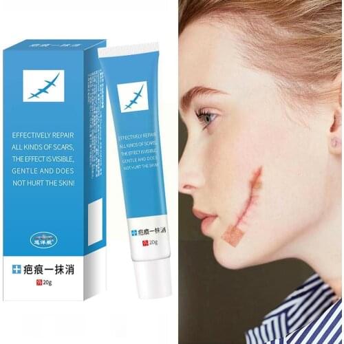 20g Scar Acne Stretch Mark Removal Ointment Gel Cream Removal For Face Face Acne Acne Scar Skin Remover Spots Cream Repair G3N3